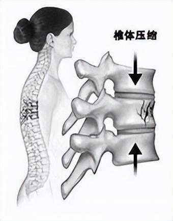 保姆与雇主起争执后腰闪了向雇主索赔23万！网友直言：判的Bsport体育好(图3)